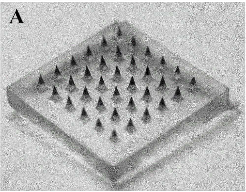 Autolytic microneedle transdermal patch and preparation method thereof