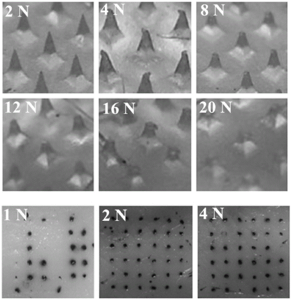 Autolytic microneedle transdermal patch and preparation method thereof