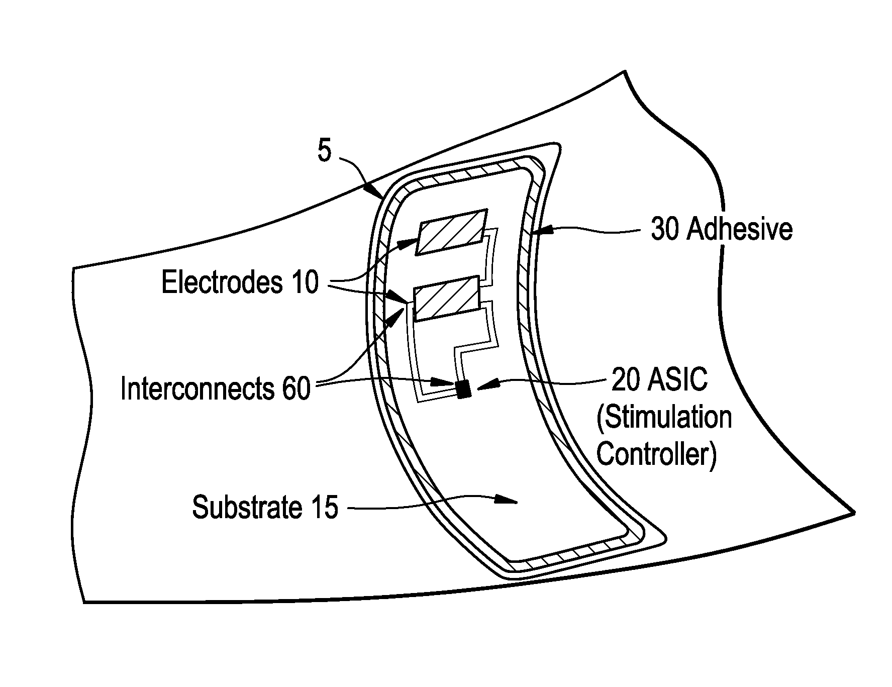 Integrated surface stimulation device for pain management and wound therapy