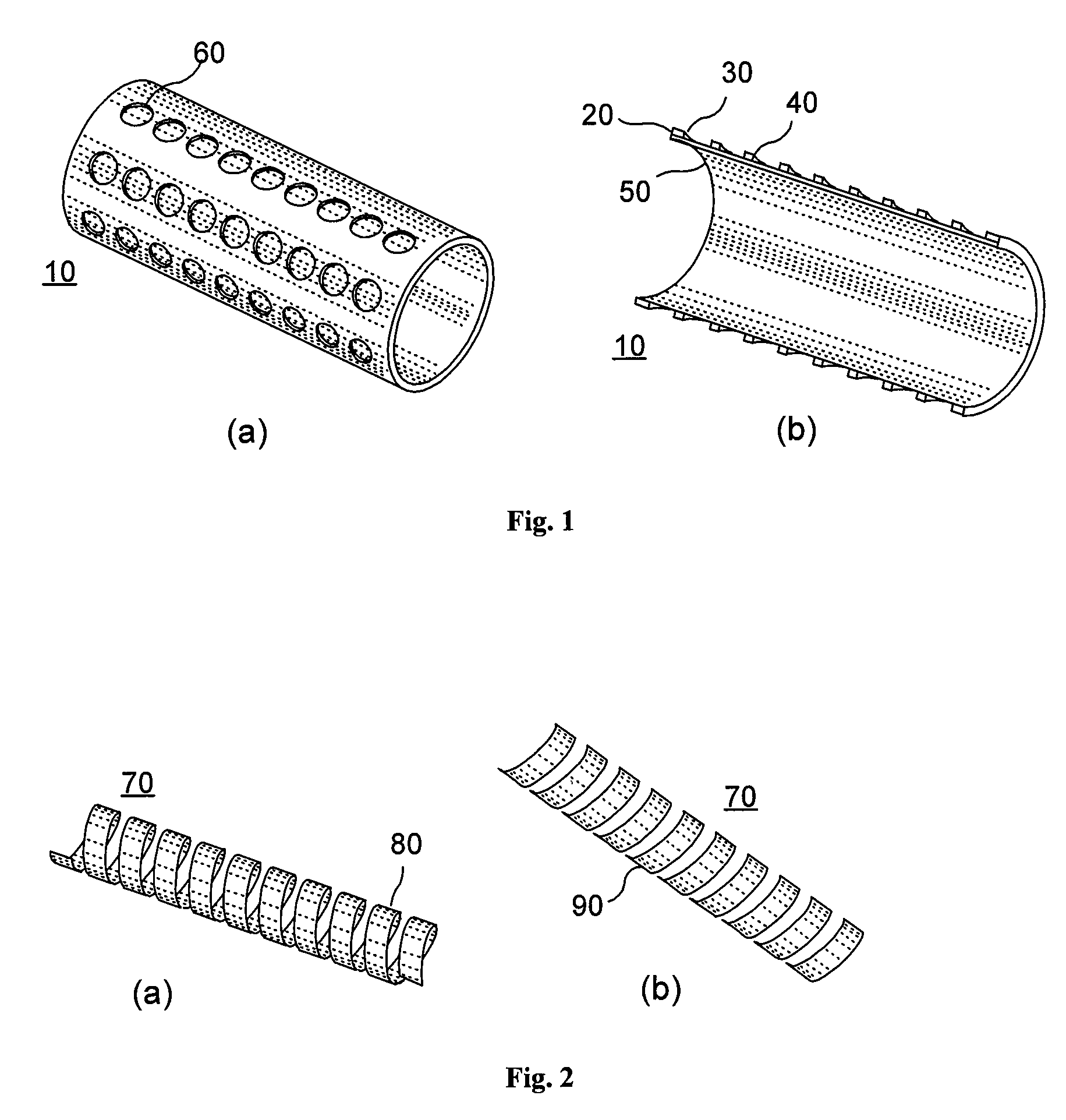 Reservoir implants and stents