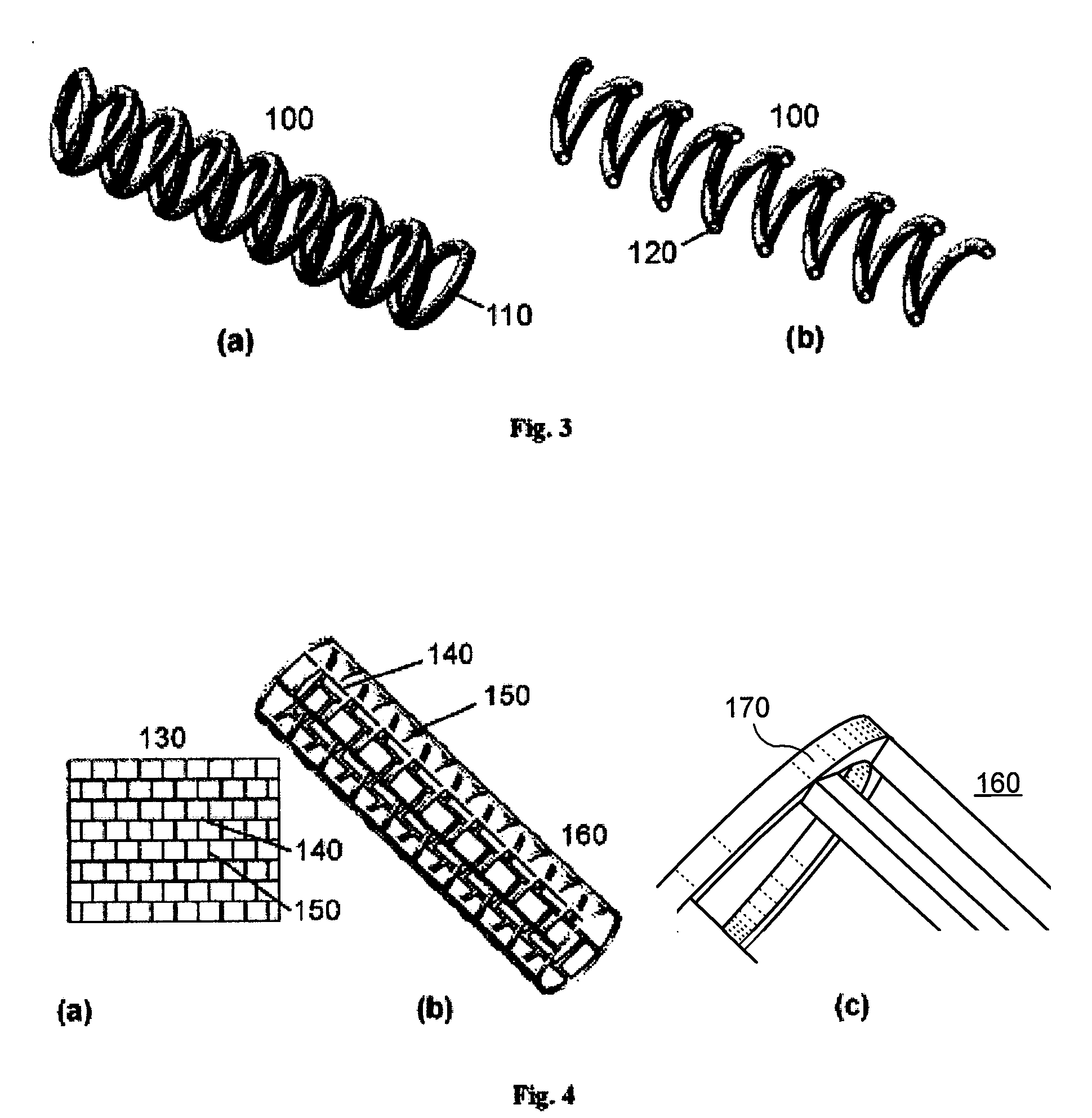 Reservoir implants and stents