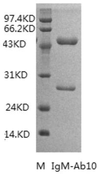 Anti-human igm monoclonal antibody, its hybridoma cell line and application