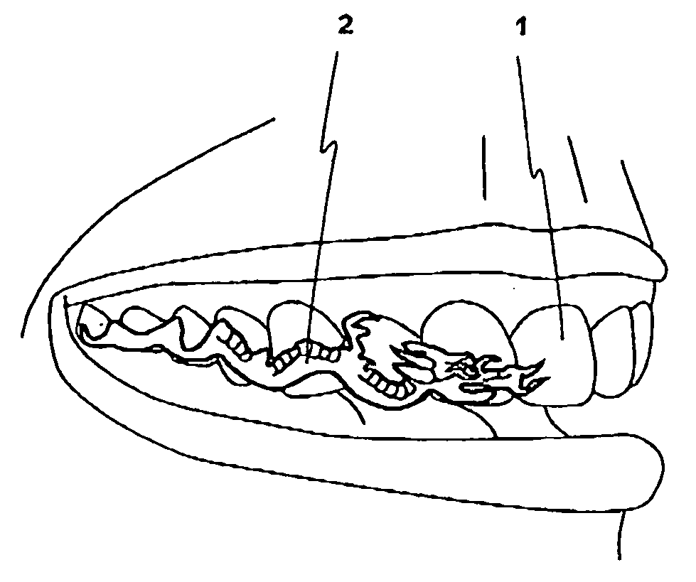 Decorative device for human teeth