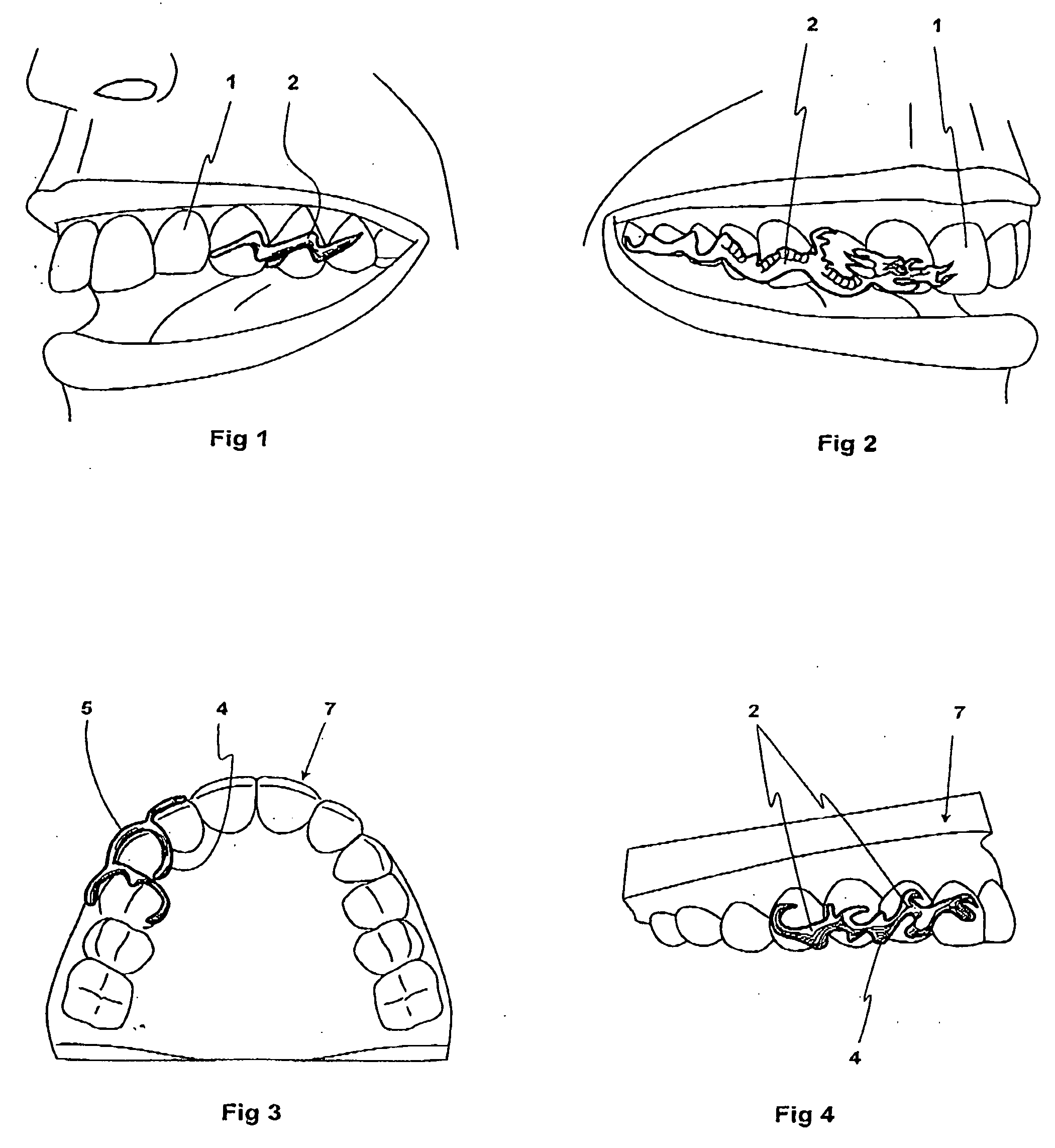 Decorative device for human teeth