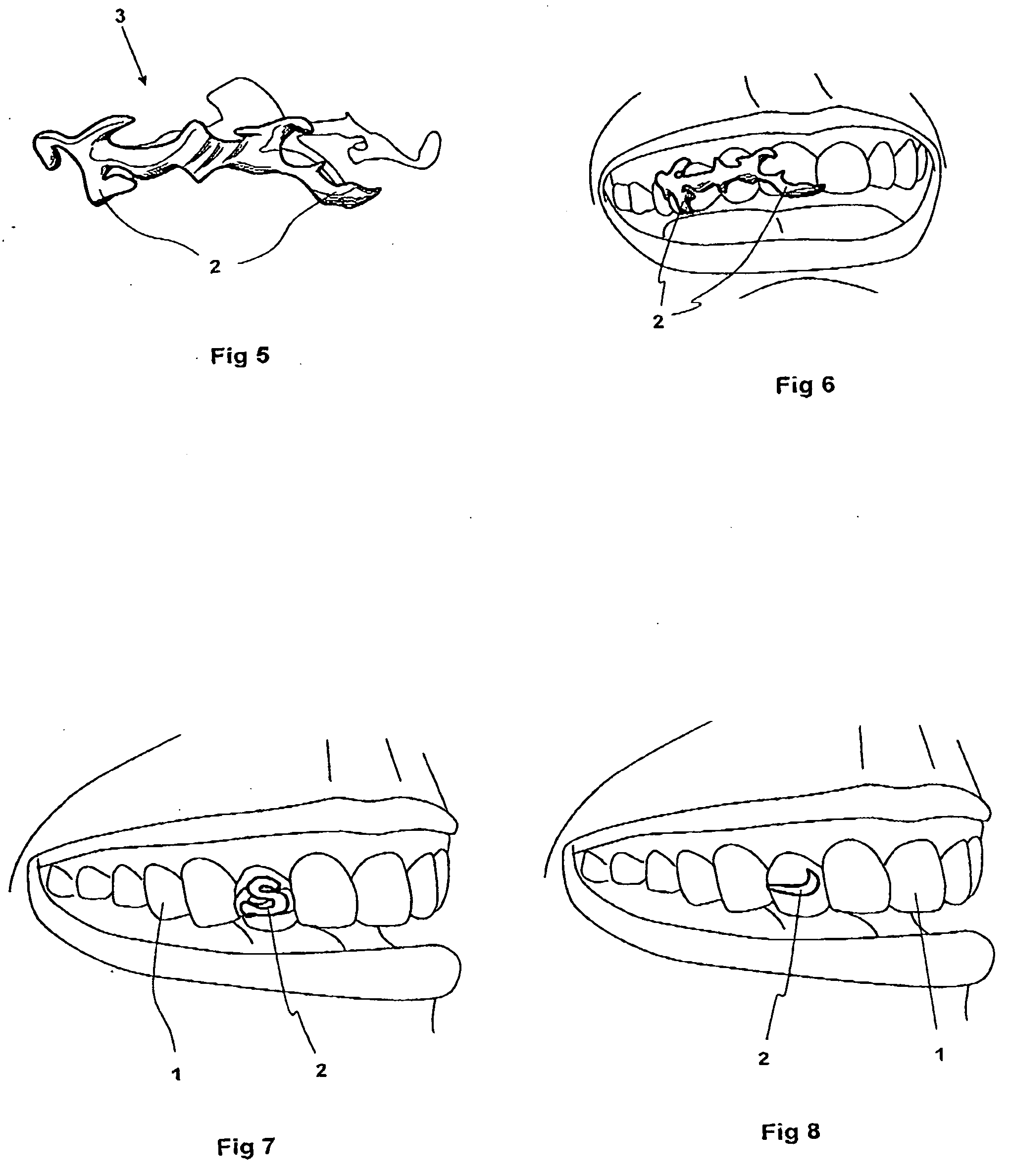 Decorative device for human teeth