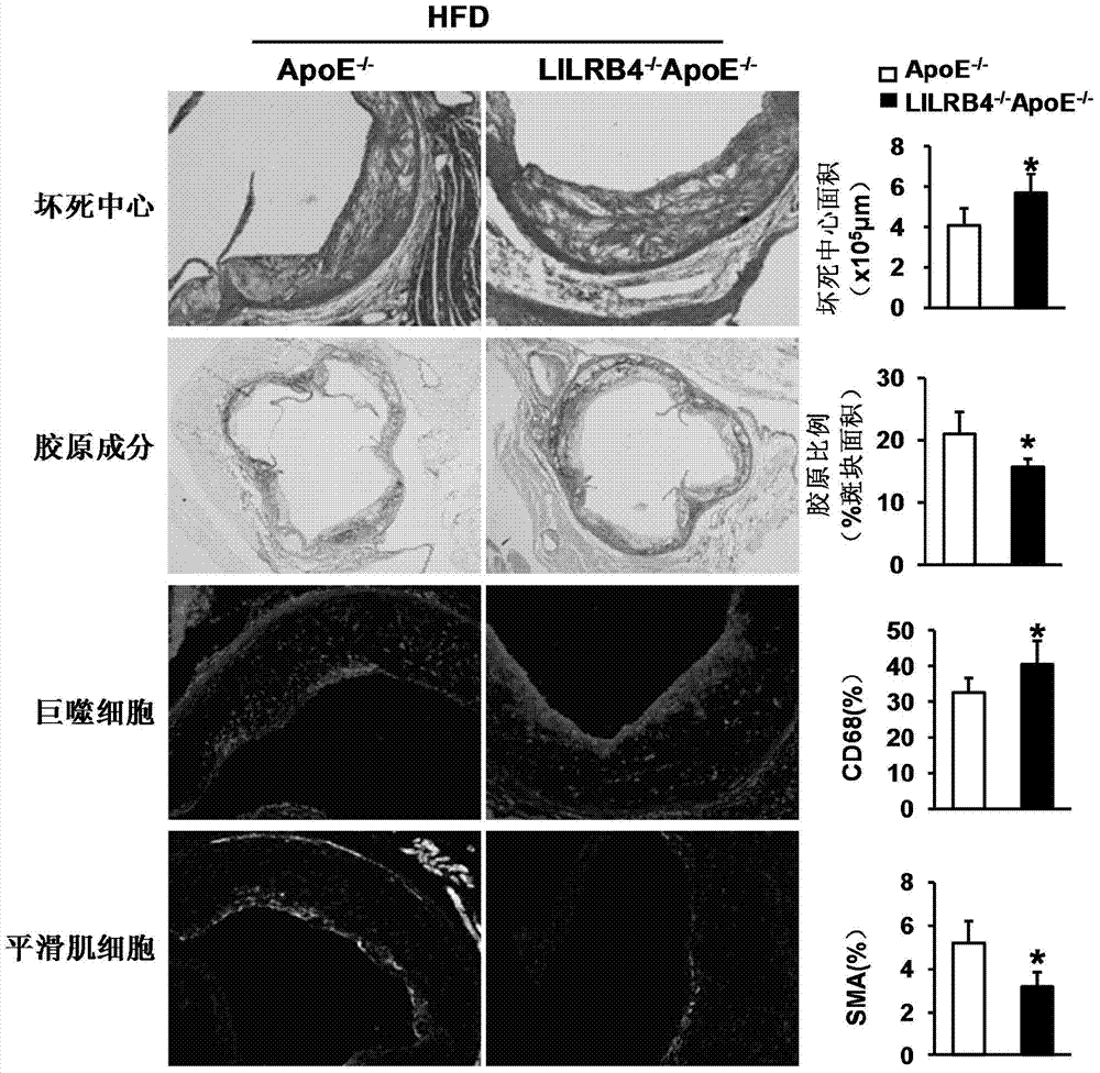 Function and application of white cell immune globulin toll-like receptor subfamily B member 4 in treatment of atherosclerosis