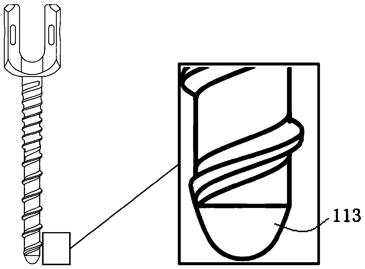 Thoracolumbar spine anterior system