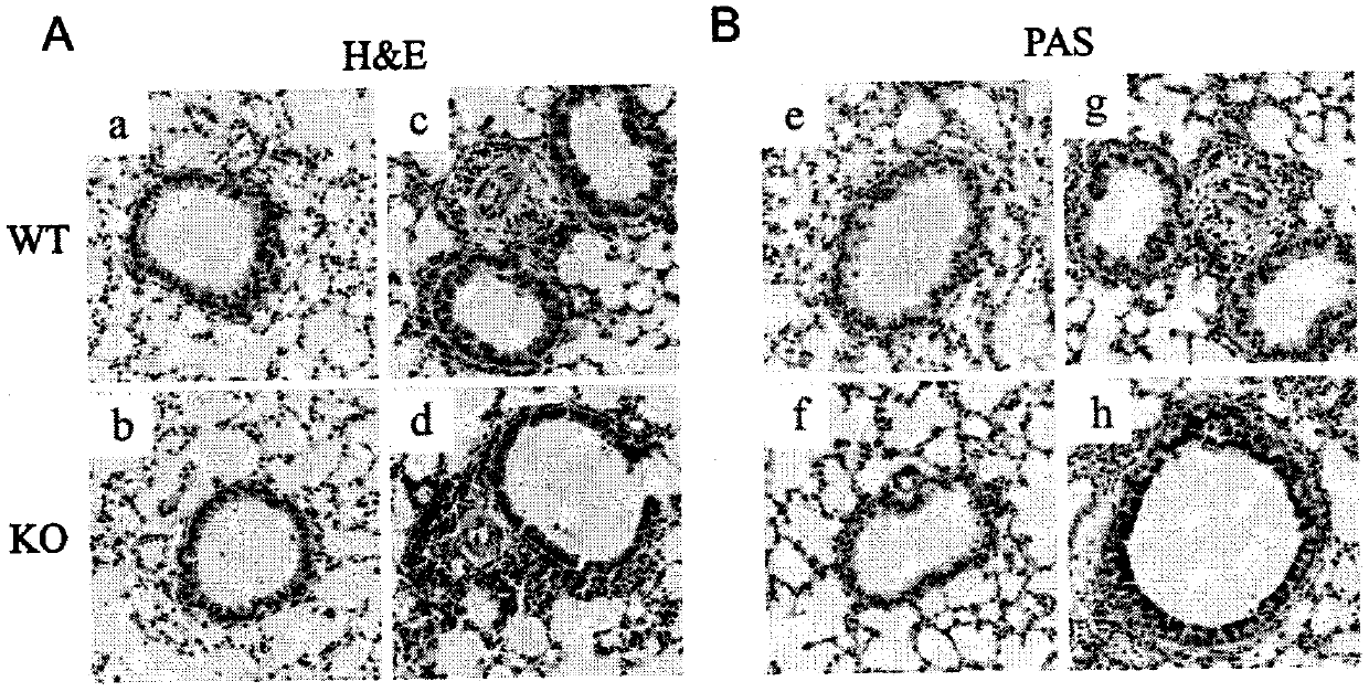 Function and application of voltage-gated proton channel Hv1 in treating allergic asthma