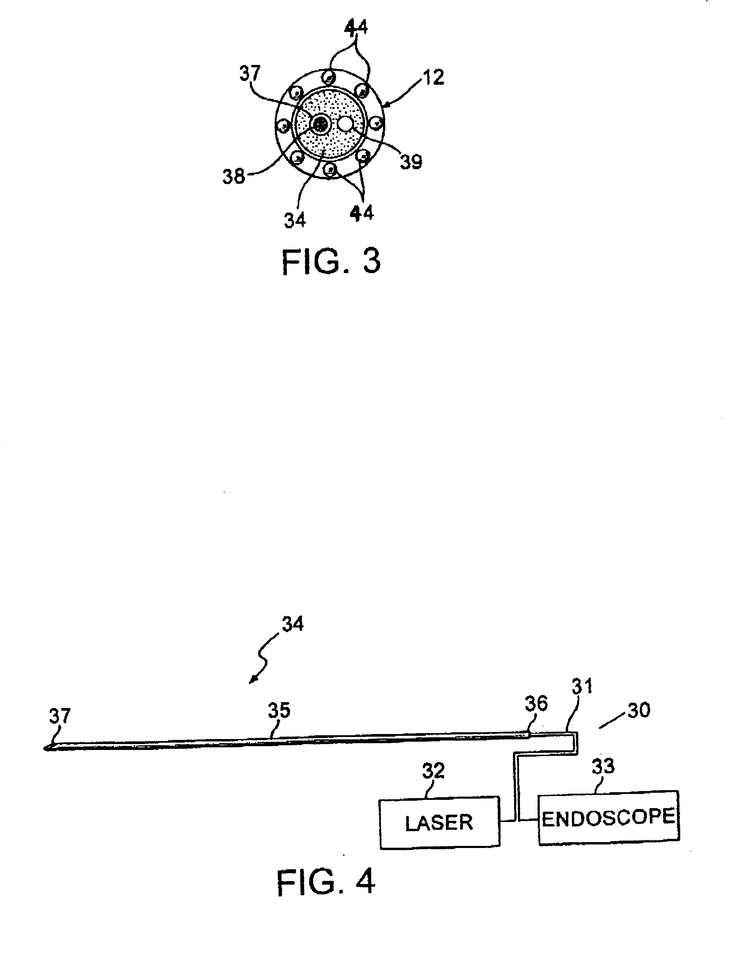 Visualizing ablation device and procedure