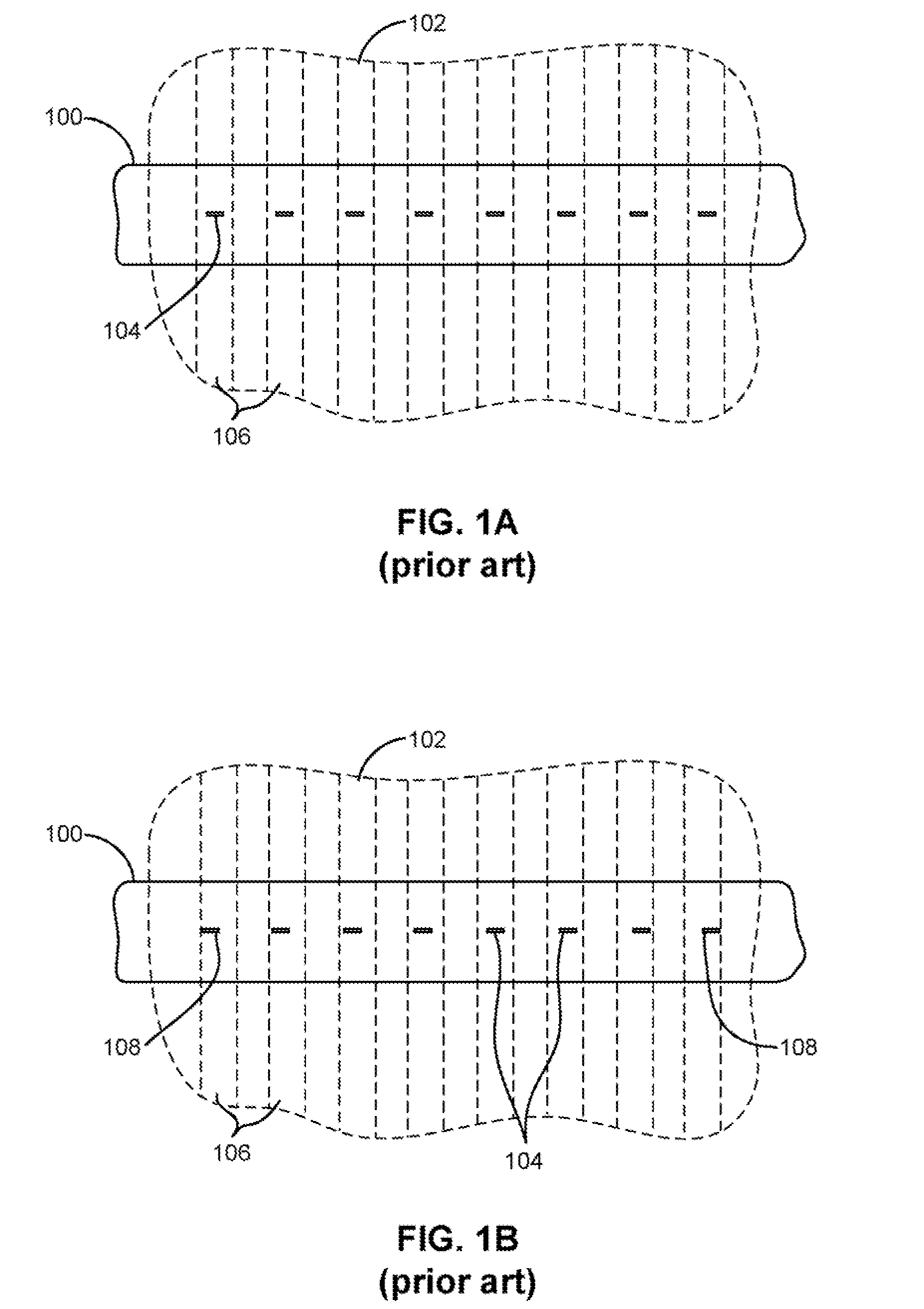 Progressive track width head and method