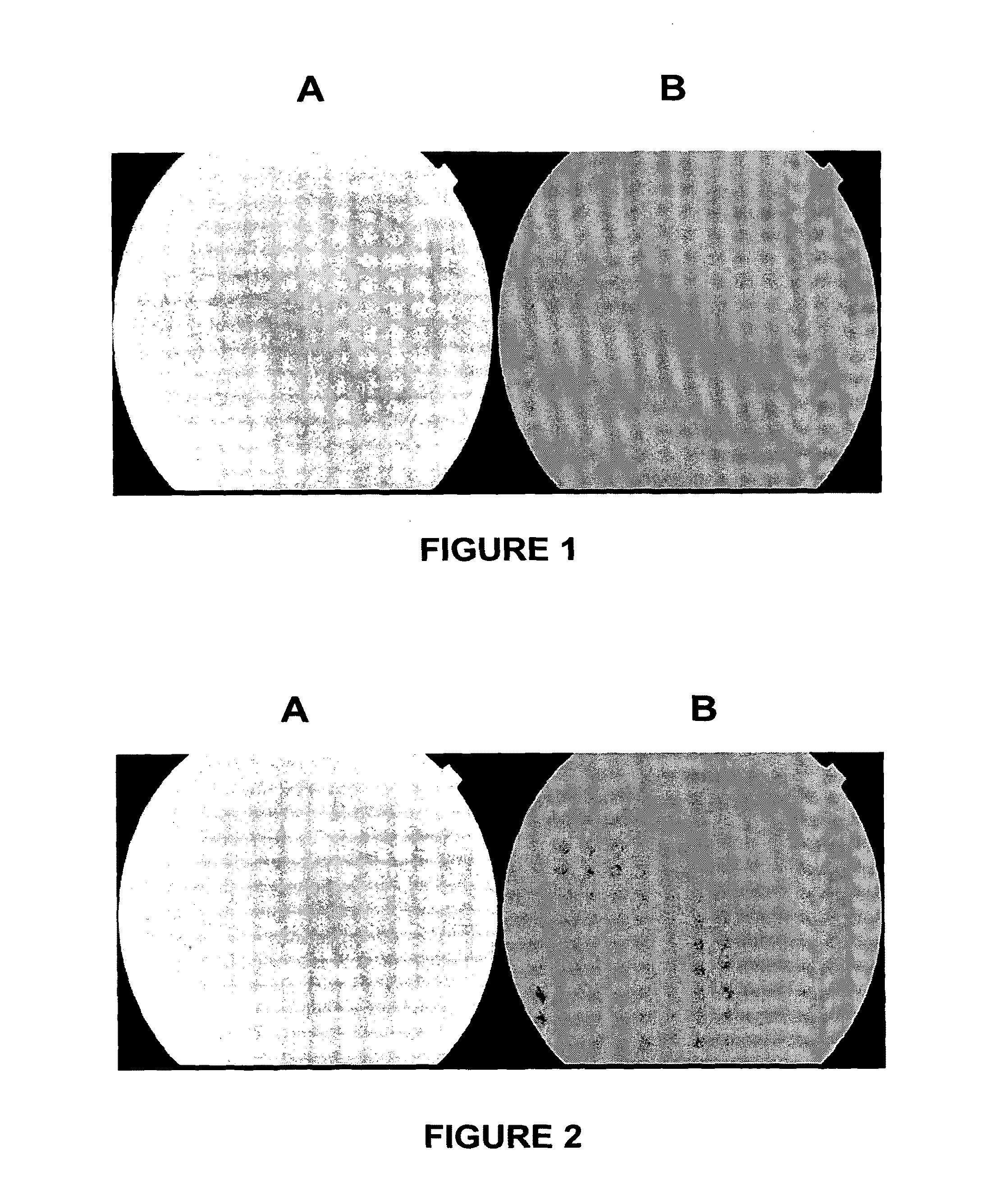 Drug delivery to the anterior and posterior segments of the eye using eye drops