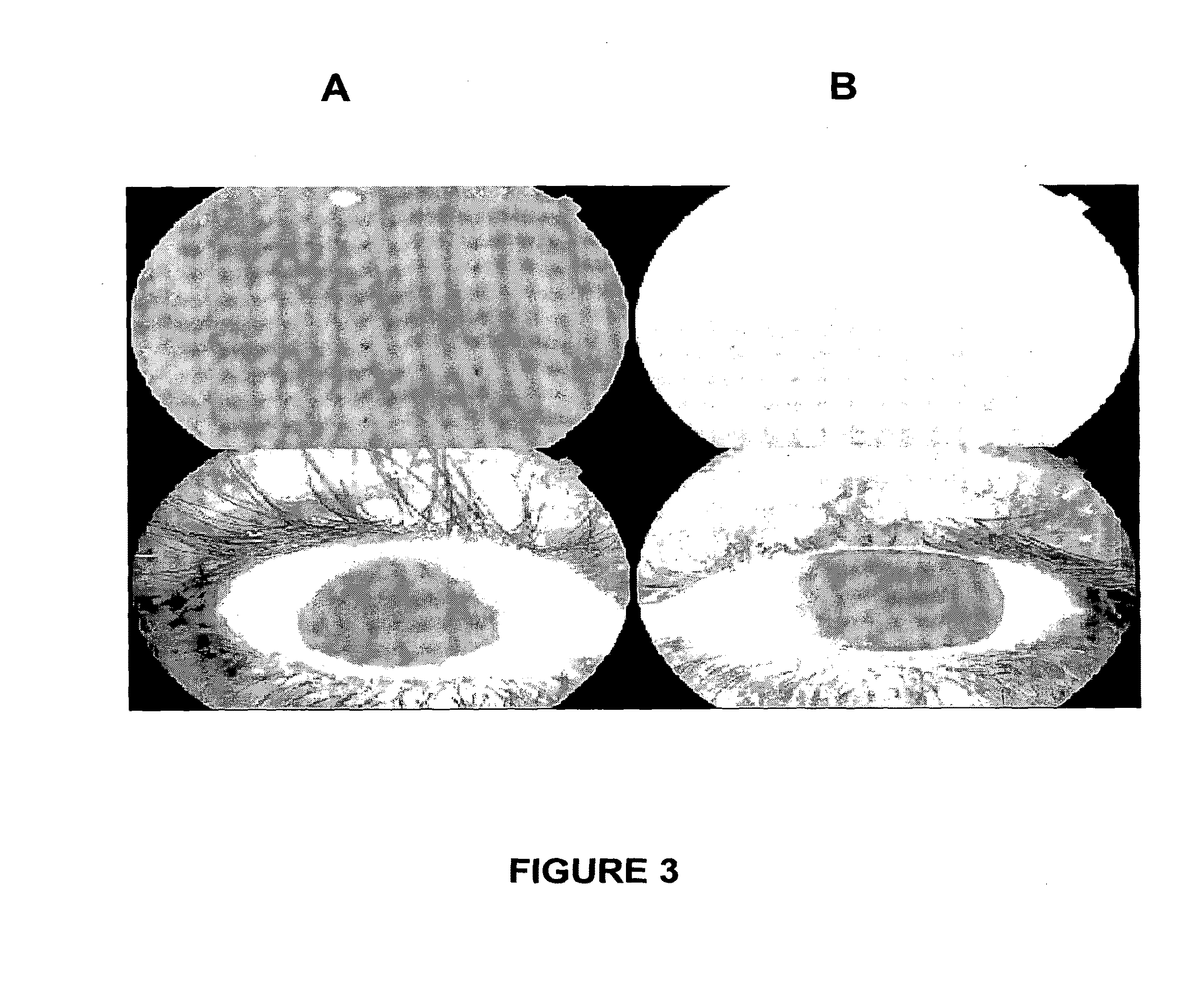 Drug delivery to the anterior and posterior segments of the eye using eye drops