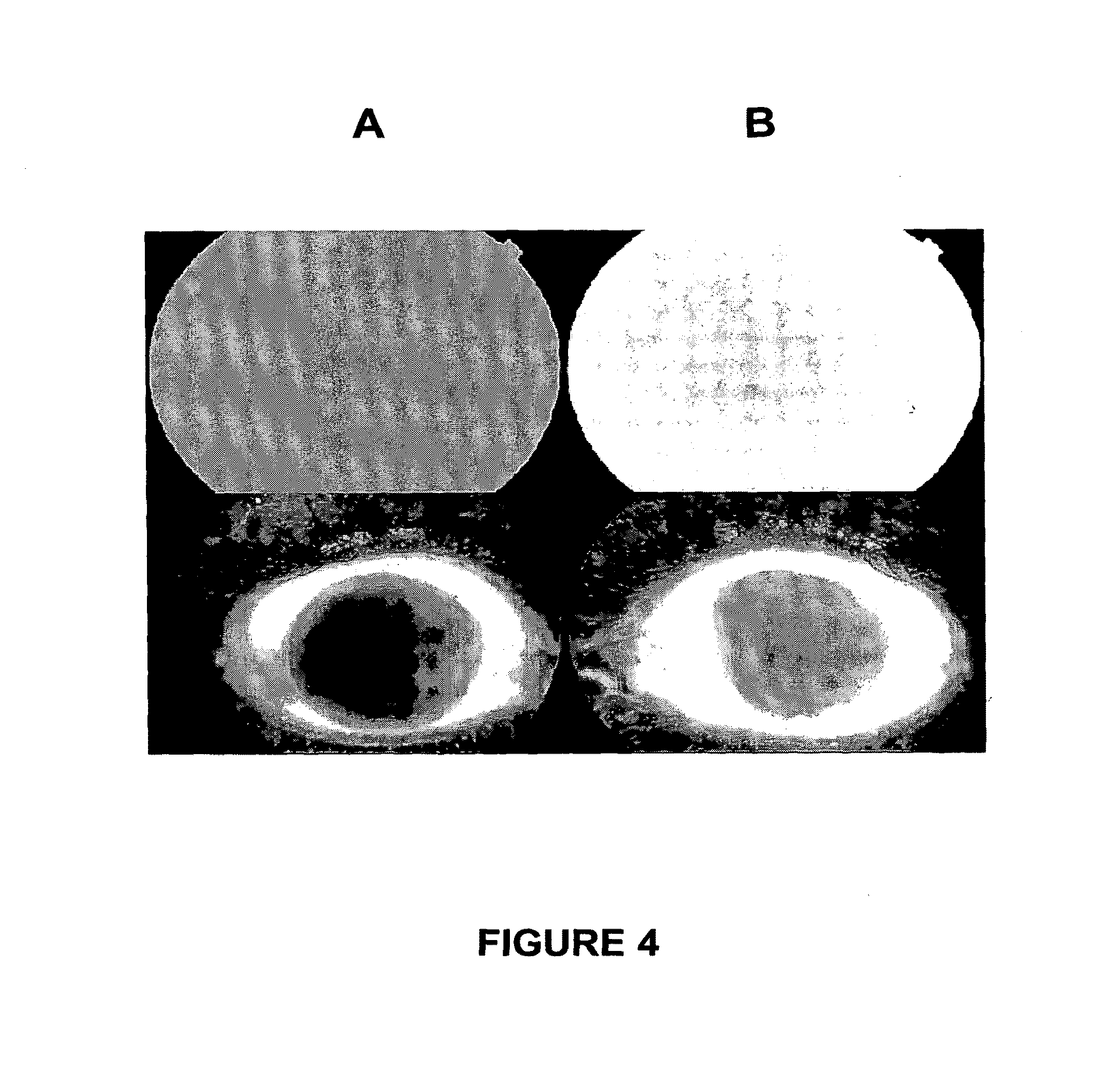 Drug delivery to the anterior and posterior segments of the eye using eye drops