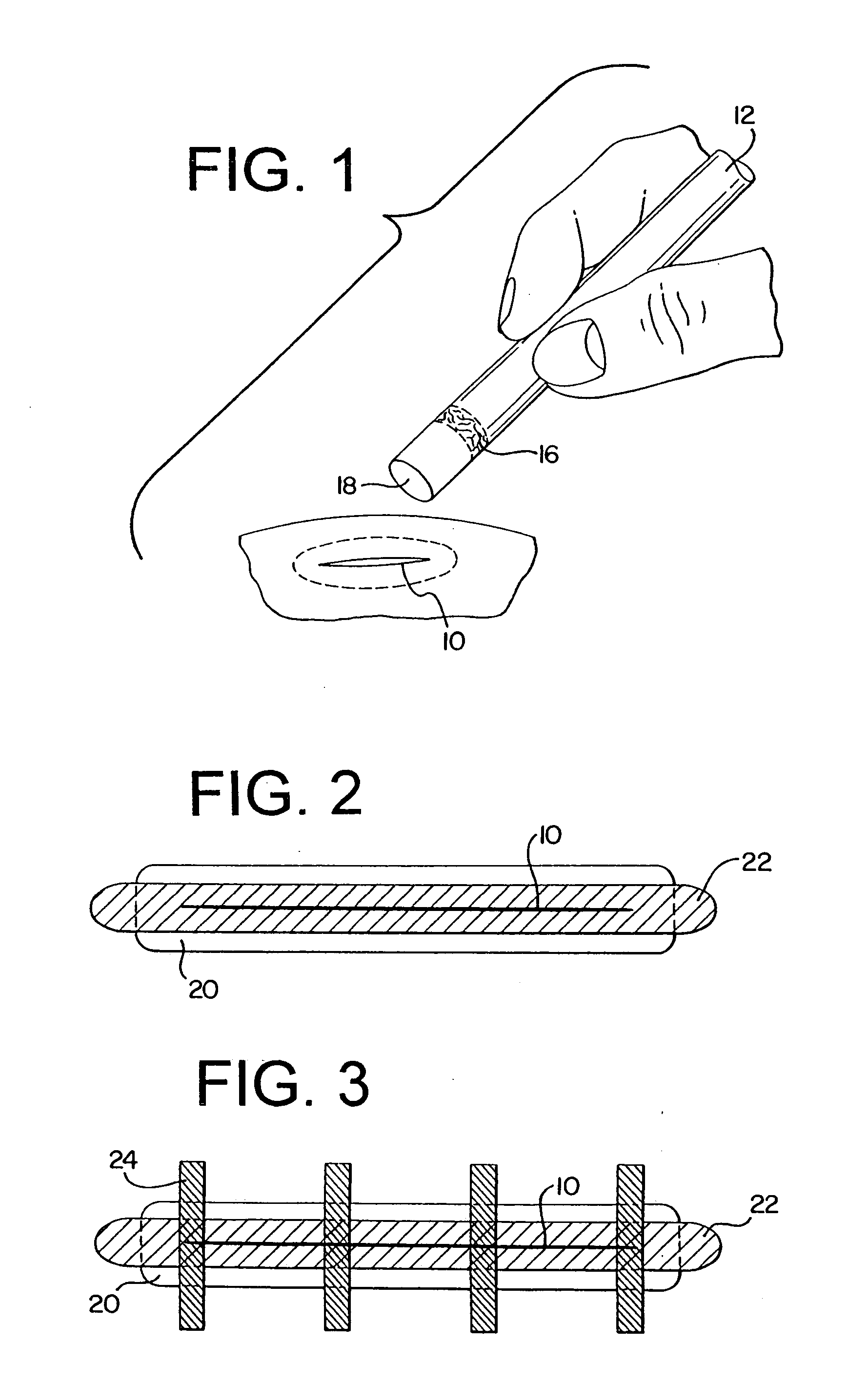 Dressing and method of treatment for a wound