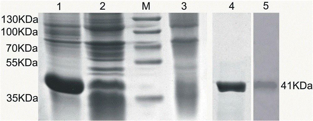 Pesticin and phage lysozyme fusion protein and encoding gene and application thereof