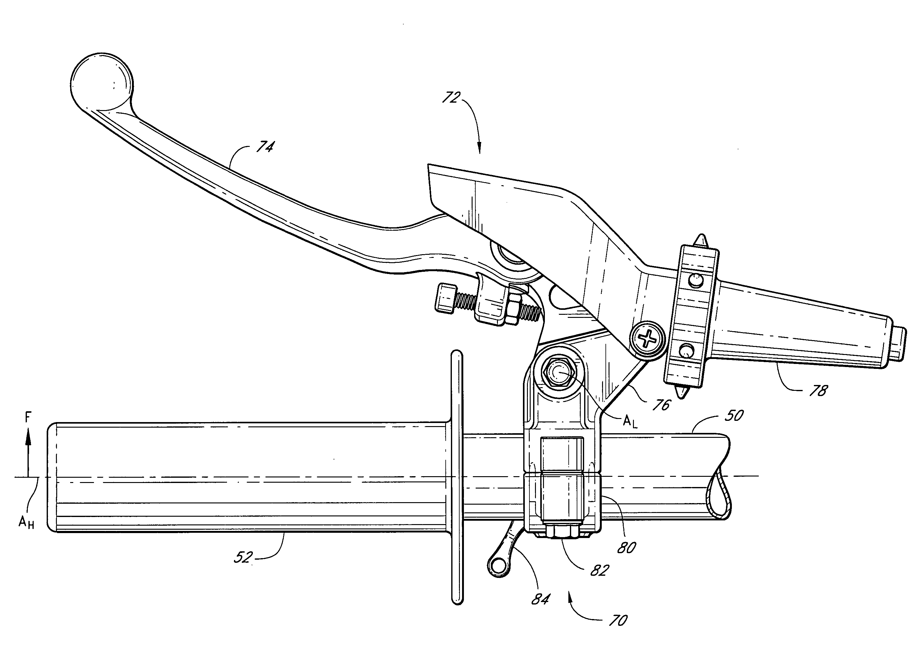 Hot start lever mount