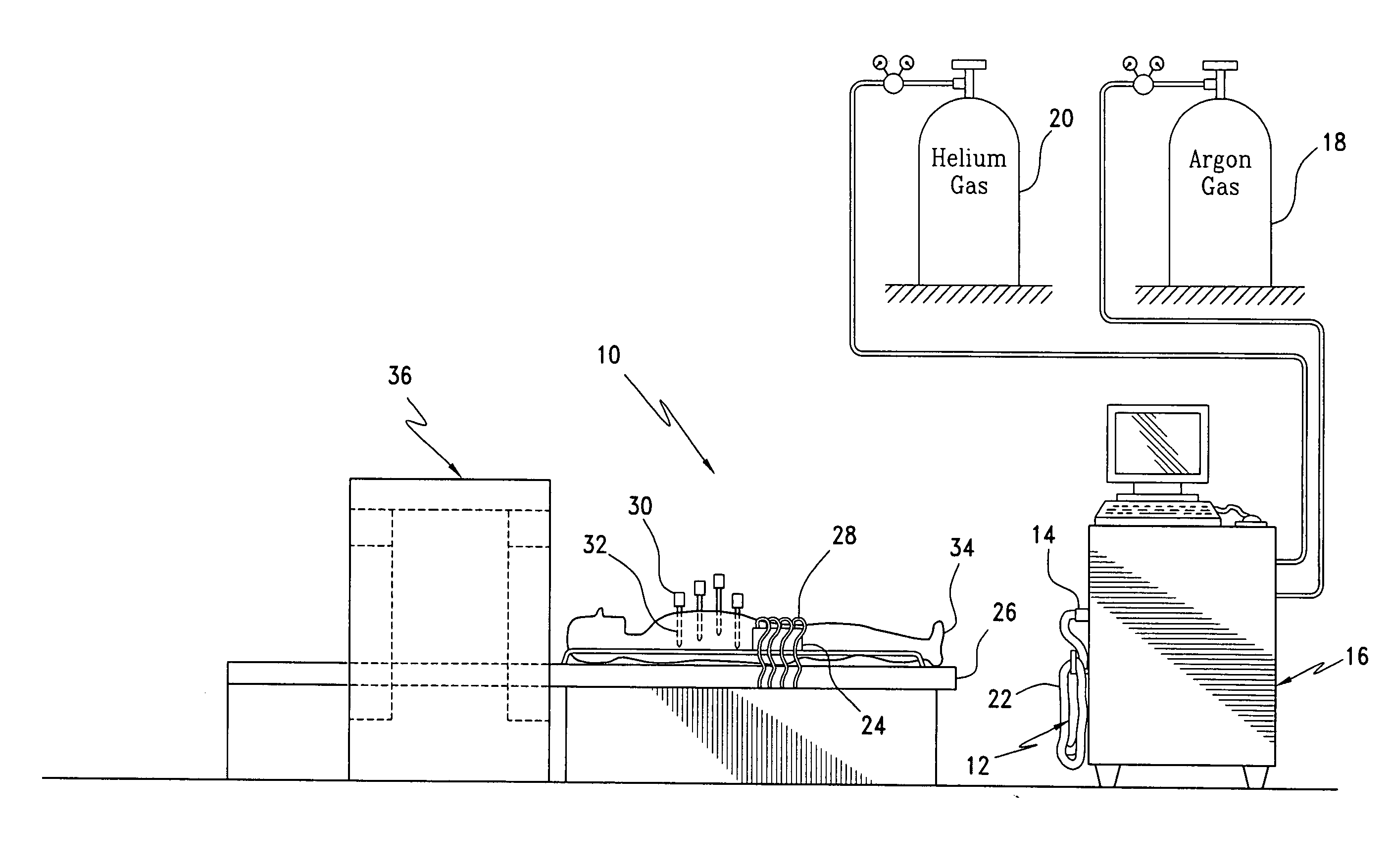 Detachable cryosurgical probe