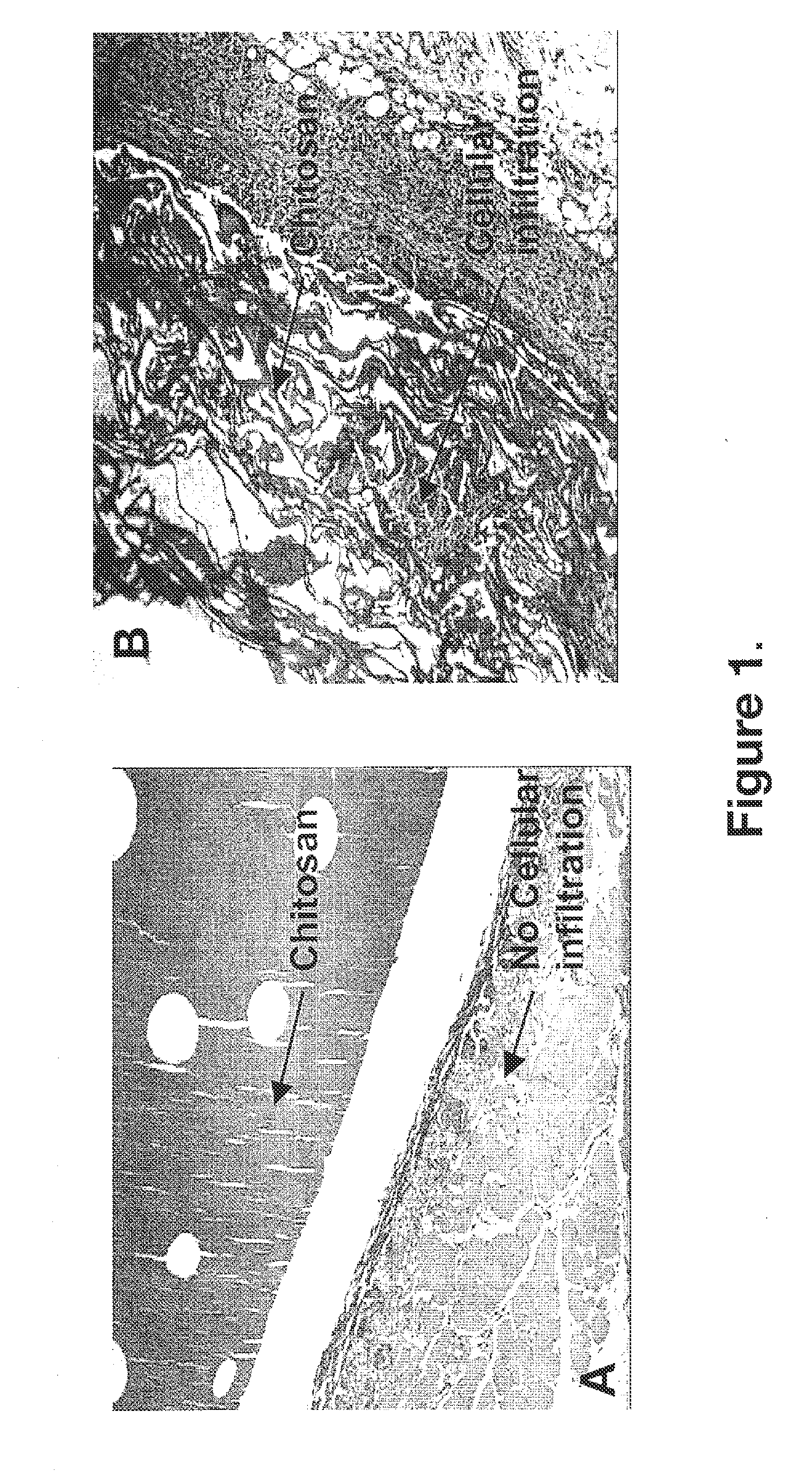 Biocompatible and bioabsorbable derivatized chitosan compositions