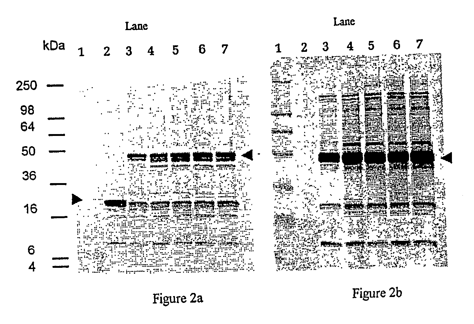 Porphyromonas gingivalis recombinant proteins and truncations