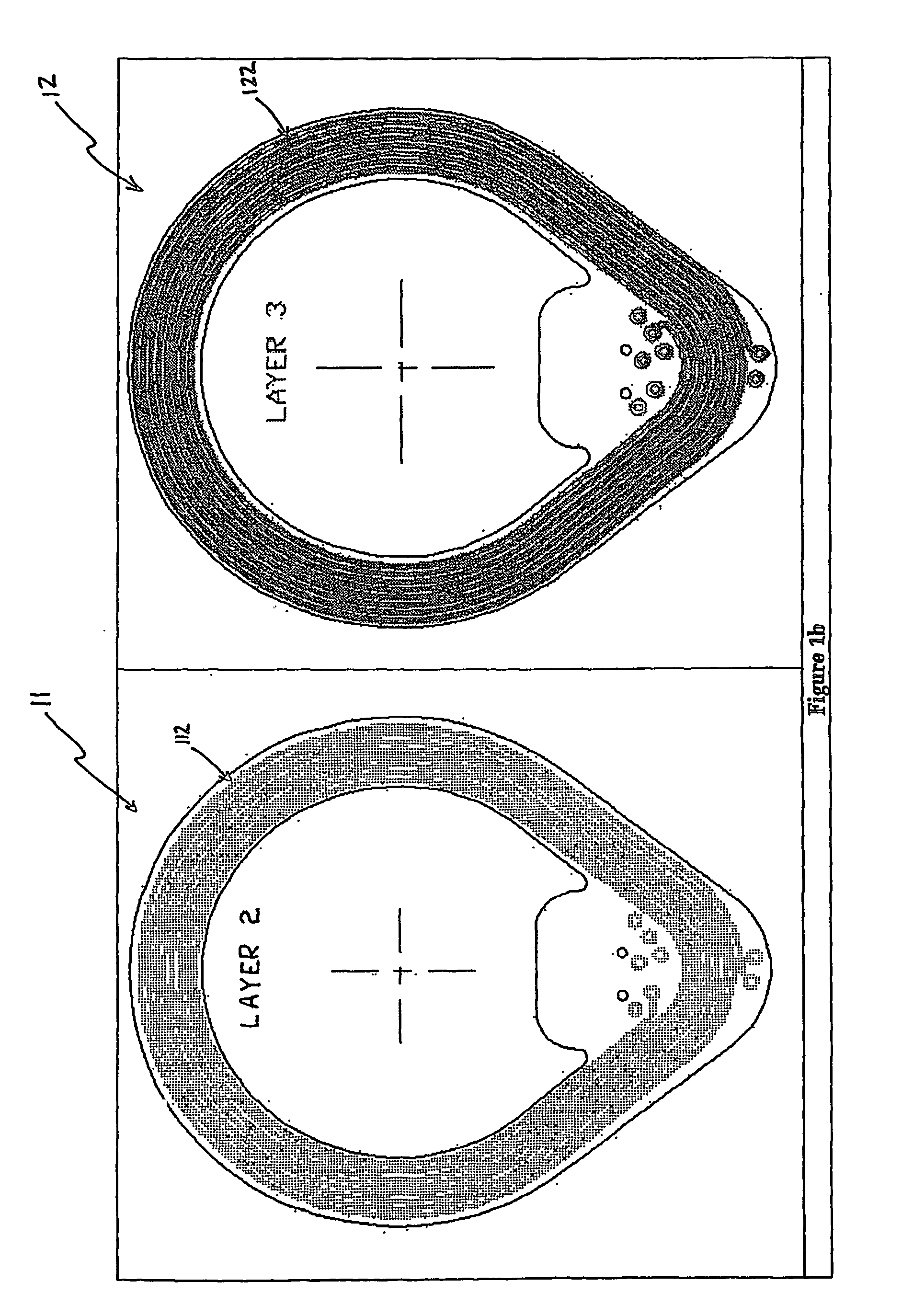 Transceiver coil for auditory prosthesis