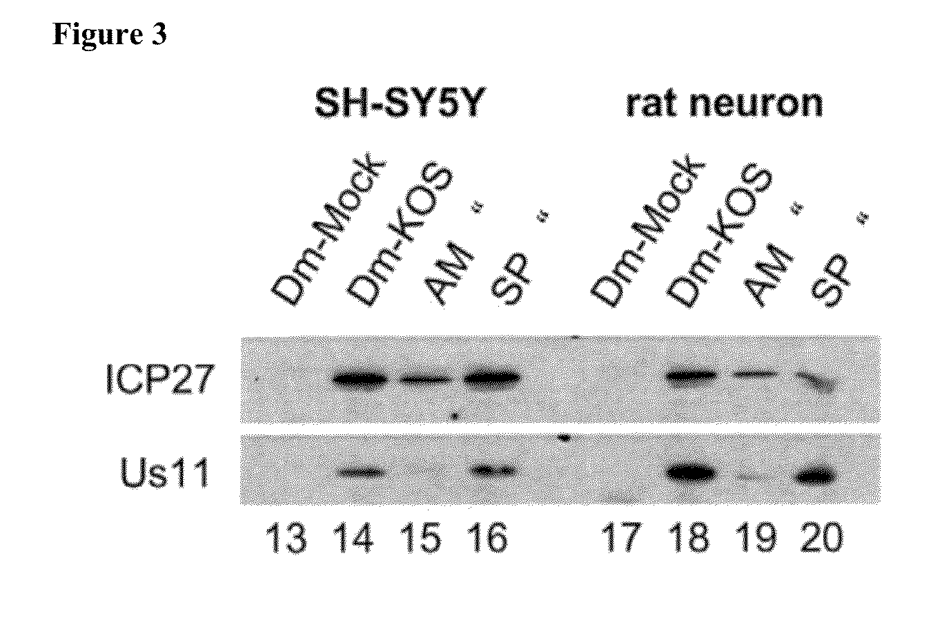 Pharmacologic treatments of meniére's disease