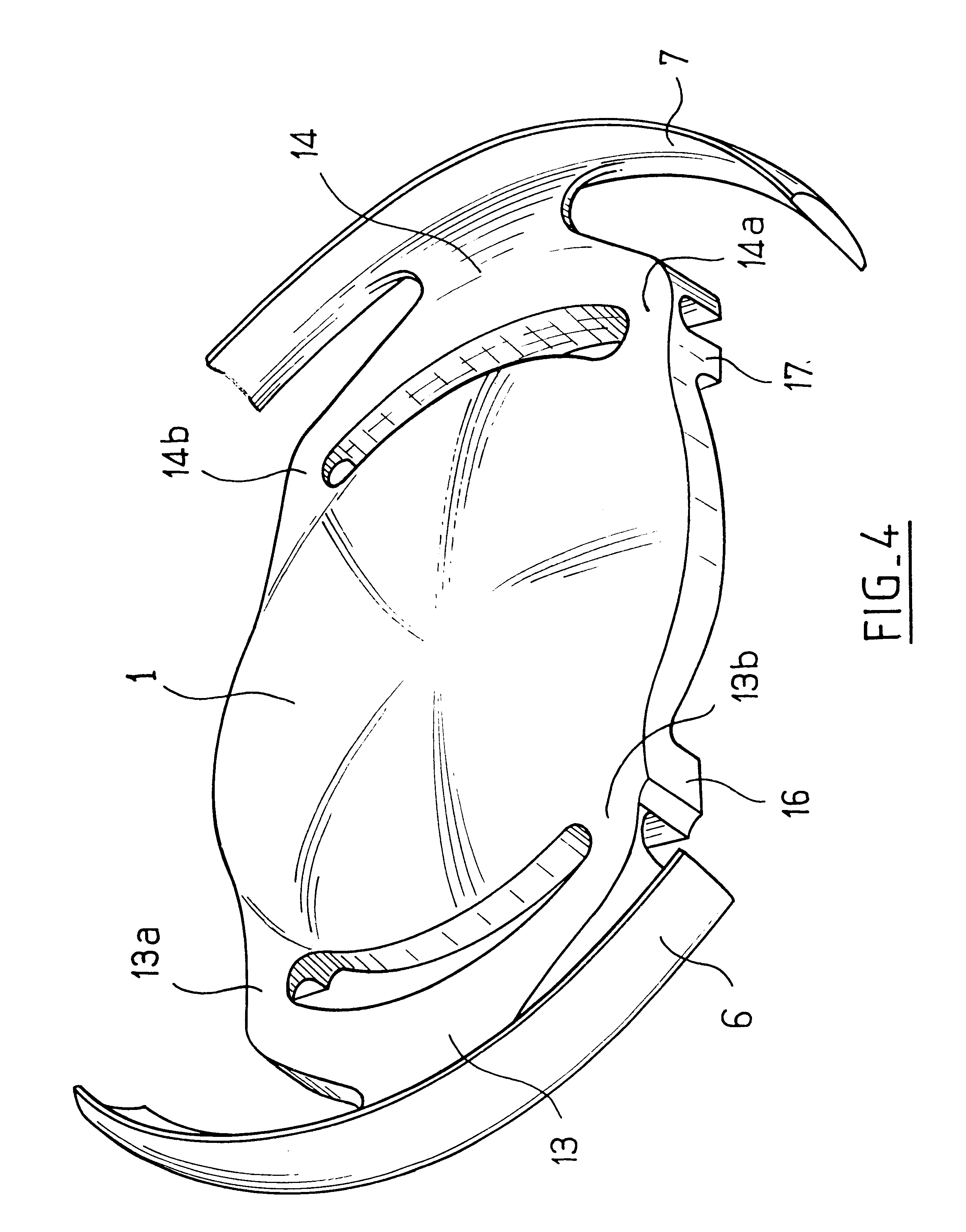 Intraocular implant and an artificial lens device