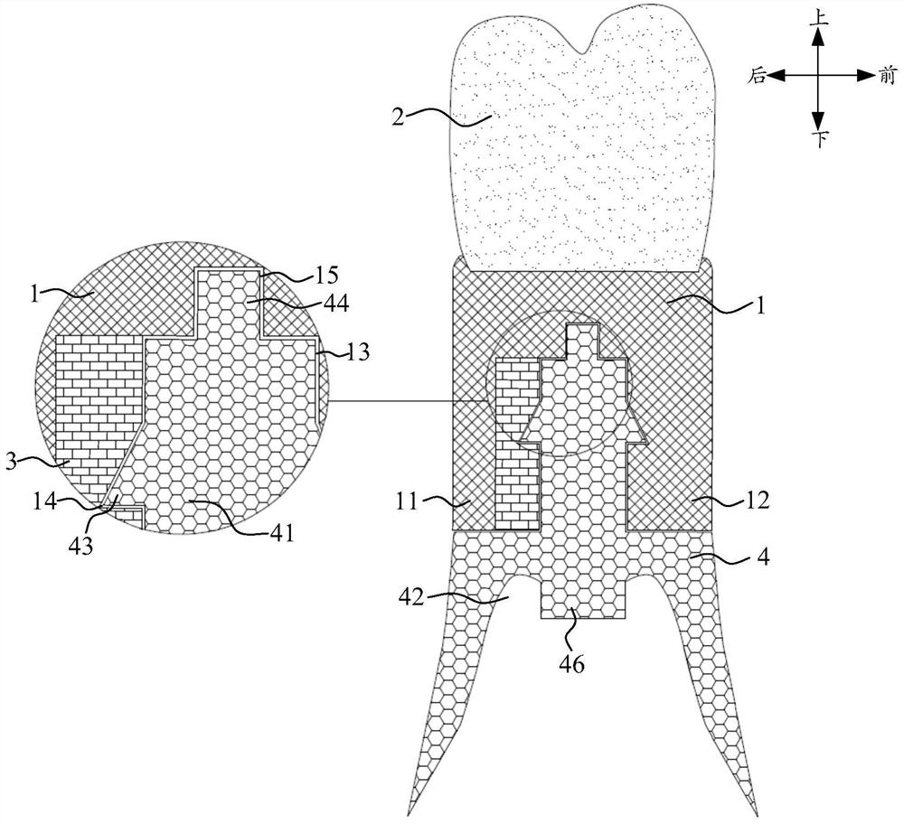 Novel false tooth with sucker and anti-abrasion gum