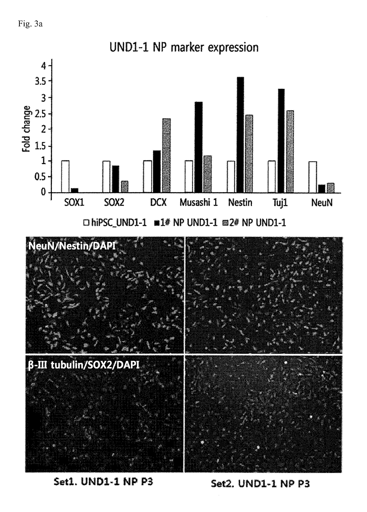 Method for producing cholinergic neural cells