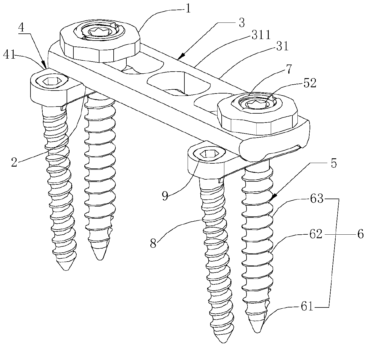 Component-based thoracolumbar anterior internal fixation system