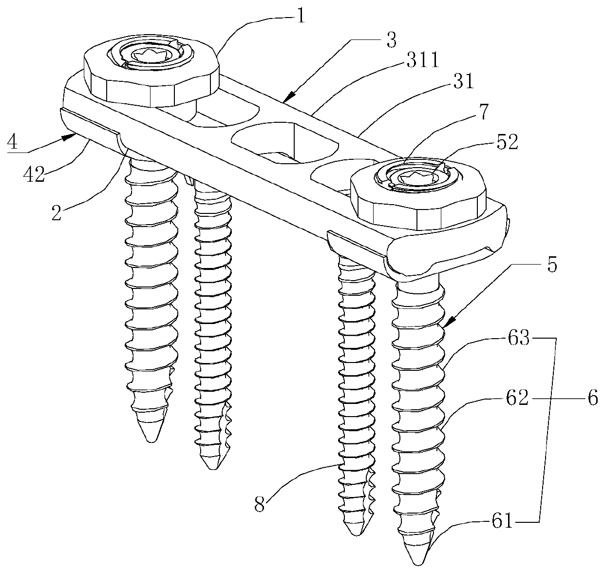 Component-based thoracolumbar anterior internal fixation system