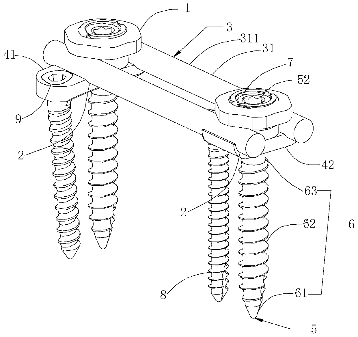 Component-based thoracolumbar anterior internal fixation system