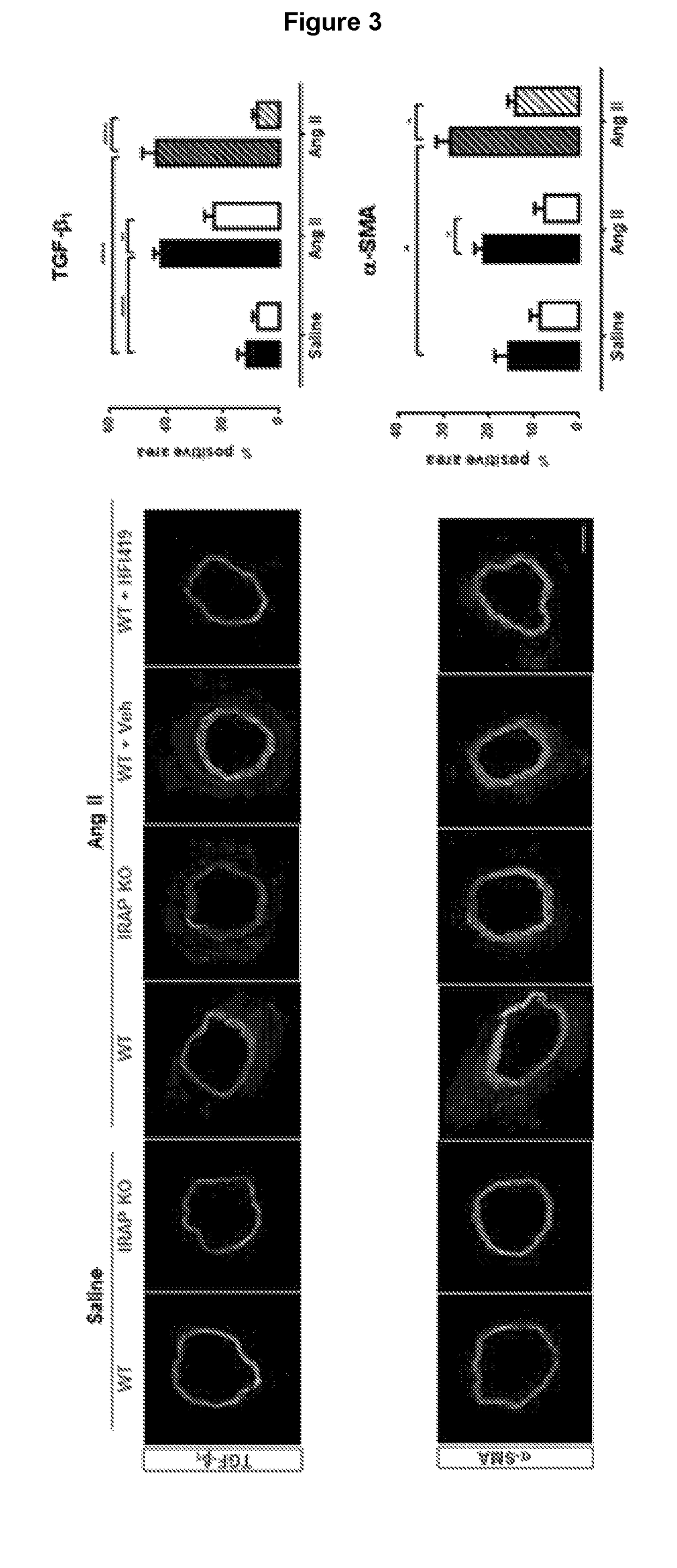 Fibrotic treatment