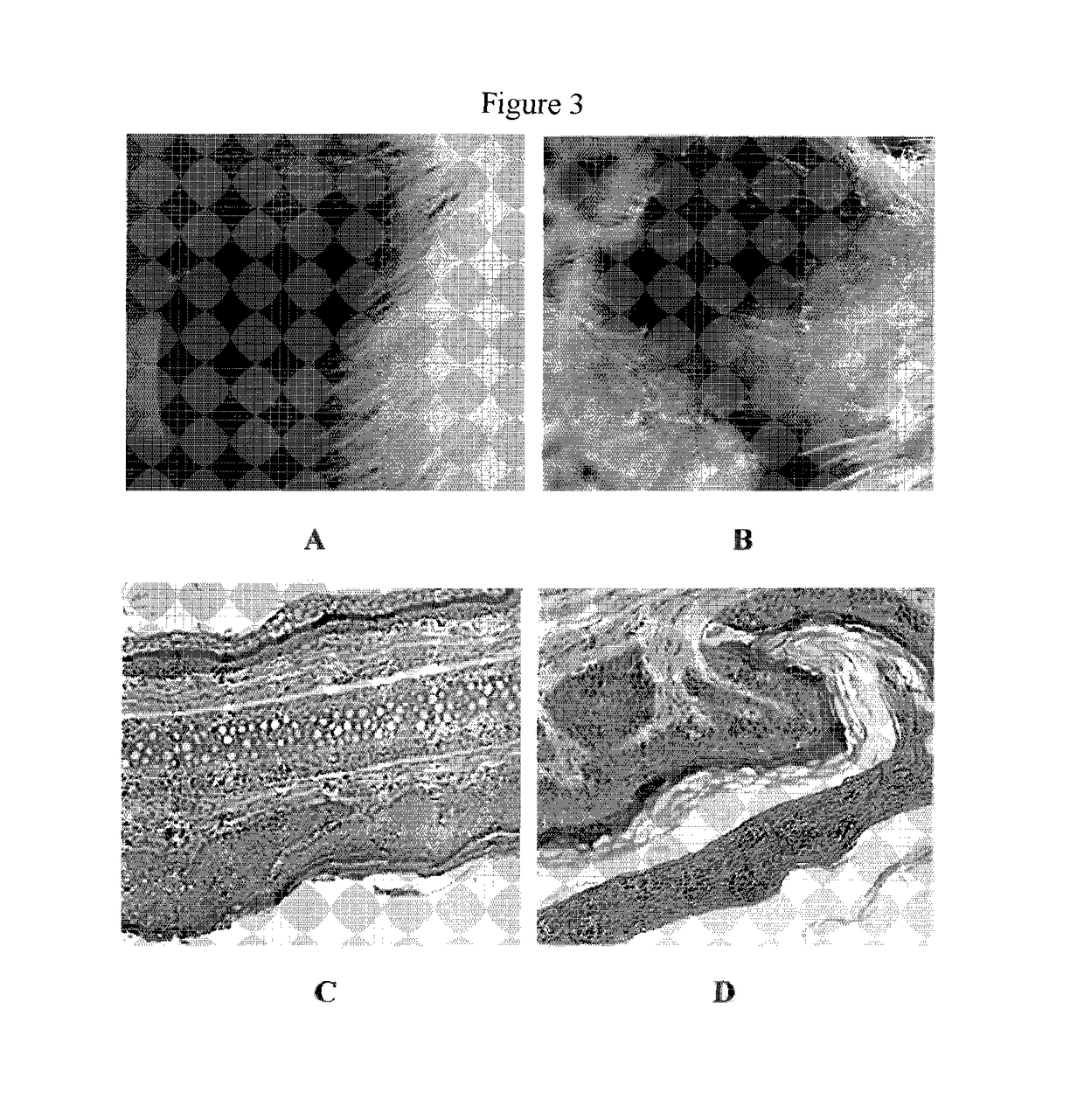 Use of α-(8-quinolinyloxy) mono-substituted phthalocyanine zinc for treatment of psoriasis