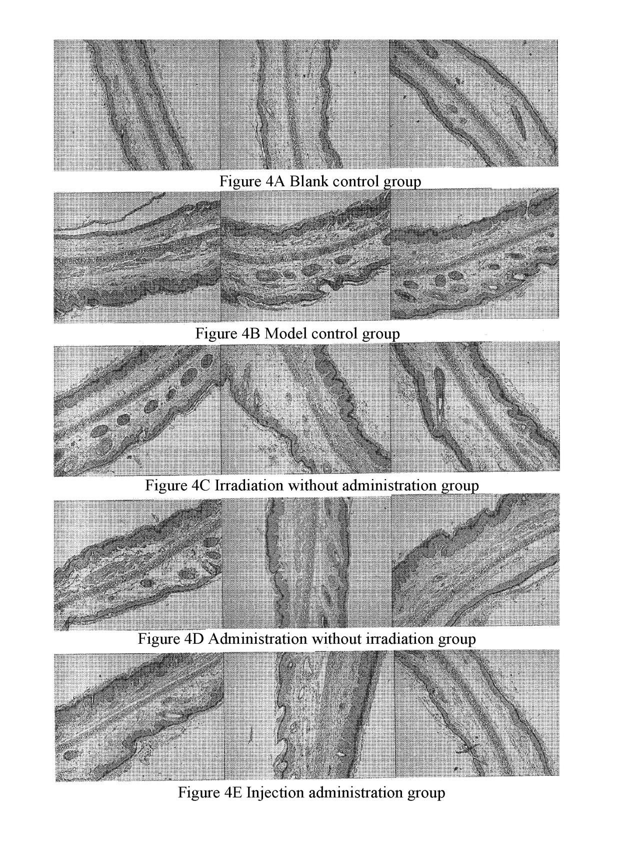 Use of α-(8-quinolinyloxy) mono-substituted phthalocyanine zinc for treatment of psoriasis