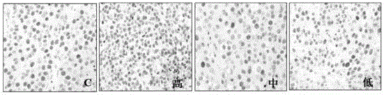 Rhodiola rosea compound effervescent tablet with lung cancer preventing effect and preparation method thereof