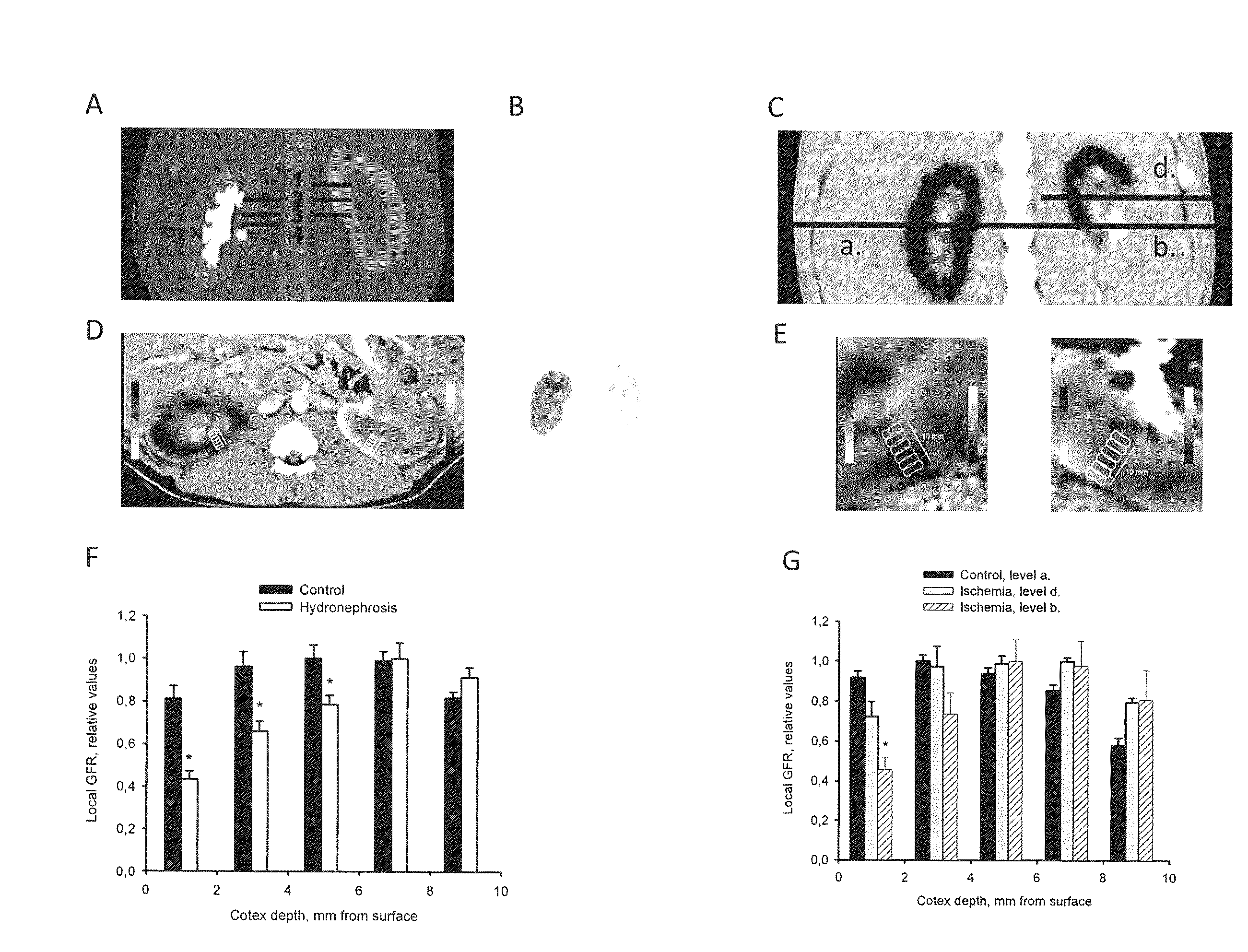 Biomolecule complexes as contrast agents in positron emission tomography (PET) based methods for the assessment of organ function