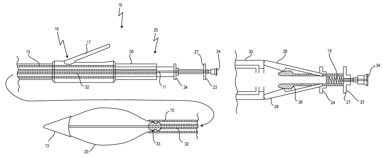 Cardiac valve prosthesis deployment system