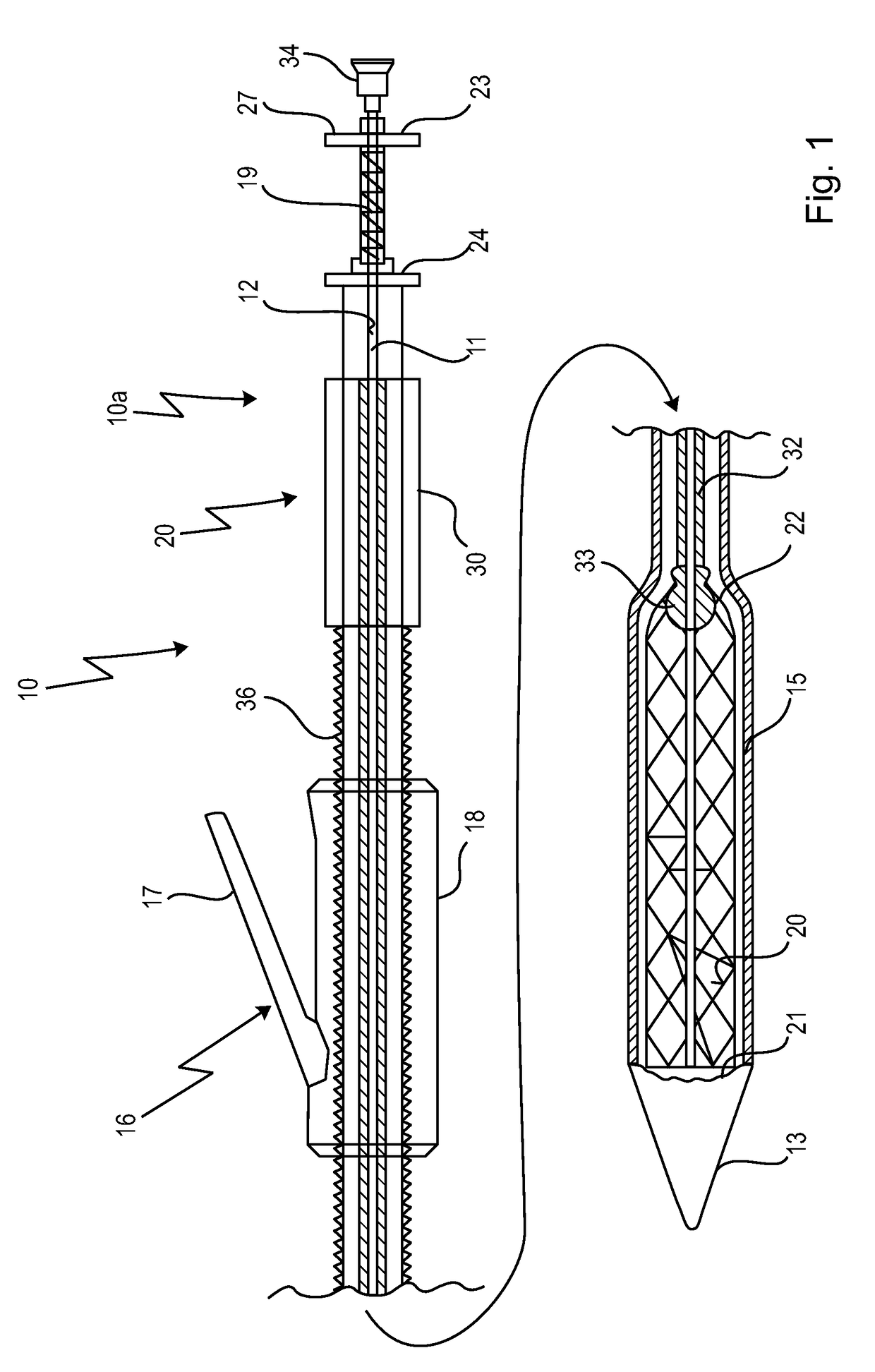 Cardiac valve prosthesis deployment system