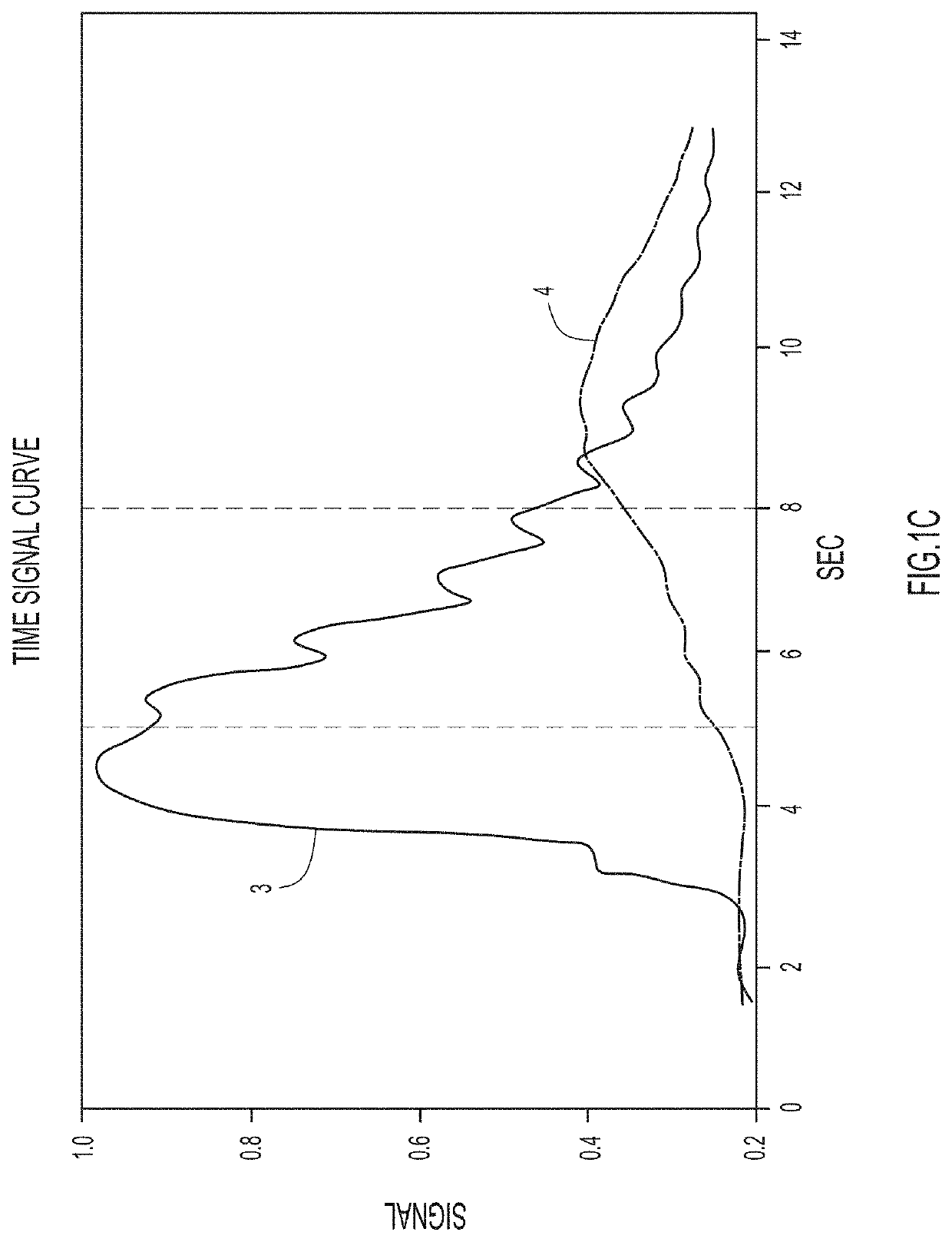 Spatiotemporal reconstruction in higher dimensions of a moving vascular pulse wave from a plurality of lower dimensional angiographic projections