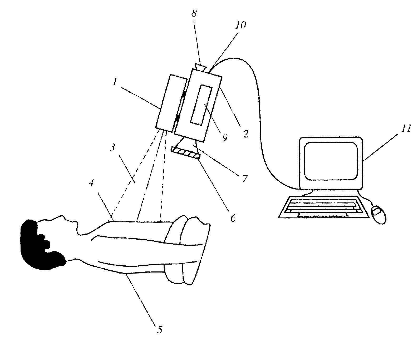 Method for evaluating blush in myocardial tissue