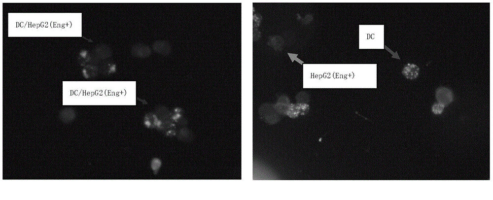 Cancer cell/DC fusion tumor vaccine for expressing Endoglin and preparation method for cancer cell/DC fusion tumor vaccine