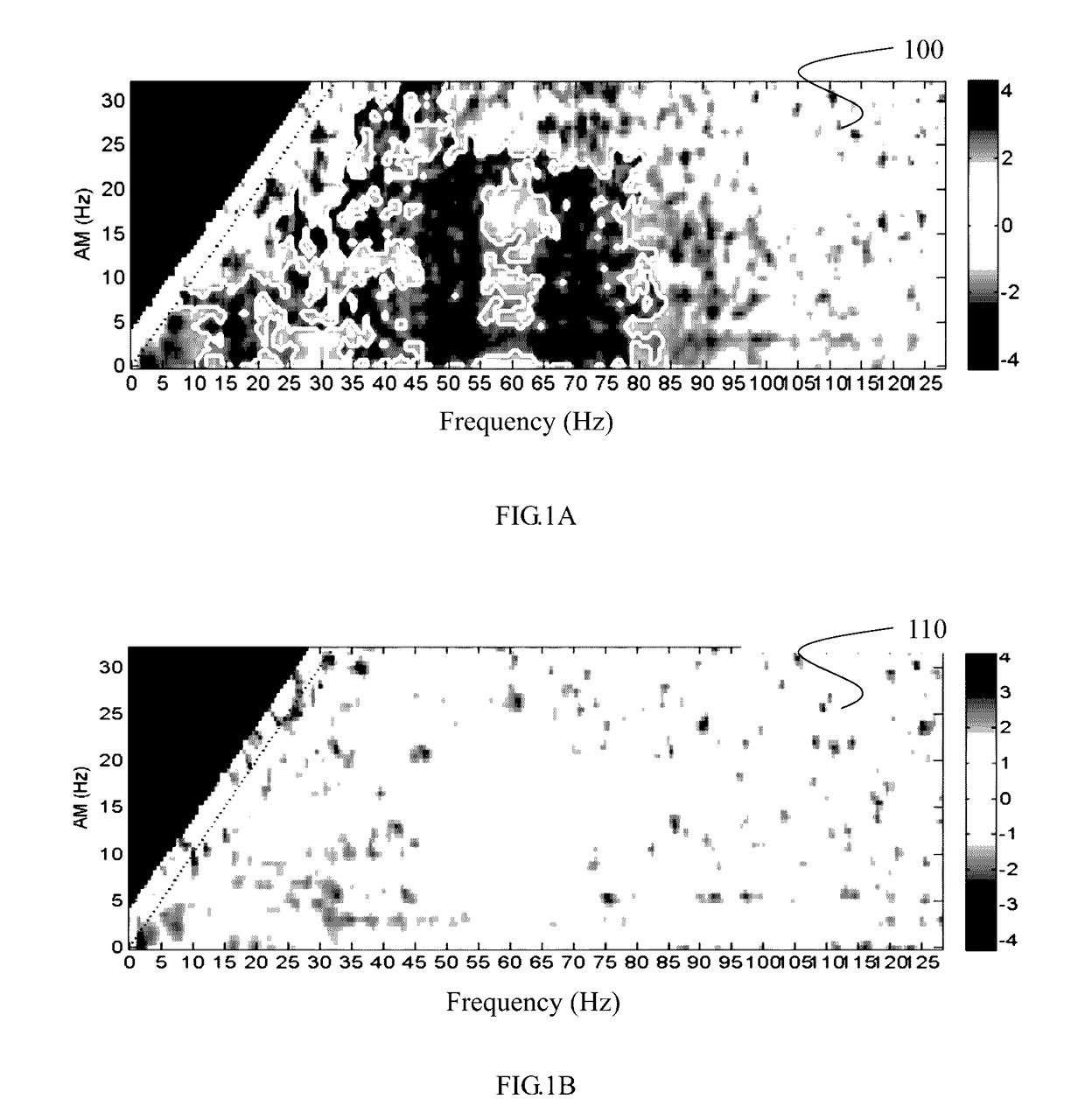 System and method for electric brain stimulator