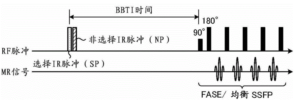 Magnetic resonance imaging apparatus