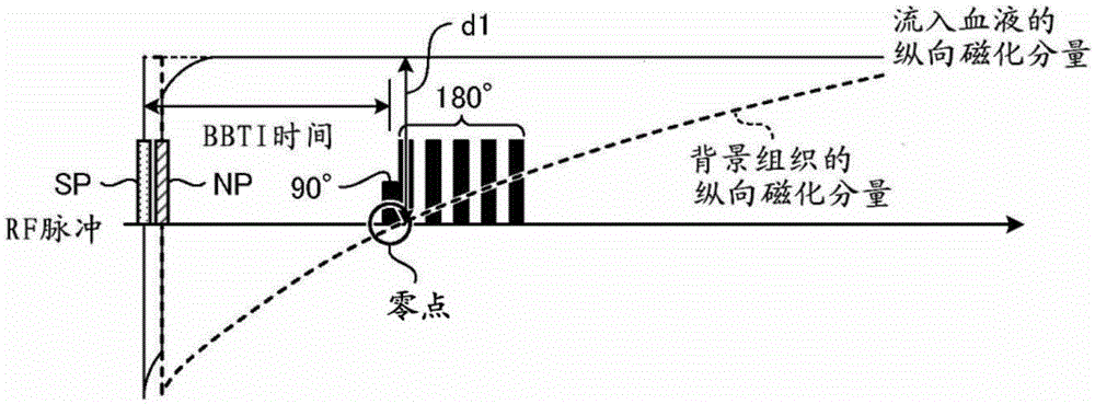 Magnetic resonance imaging apparatus