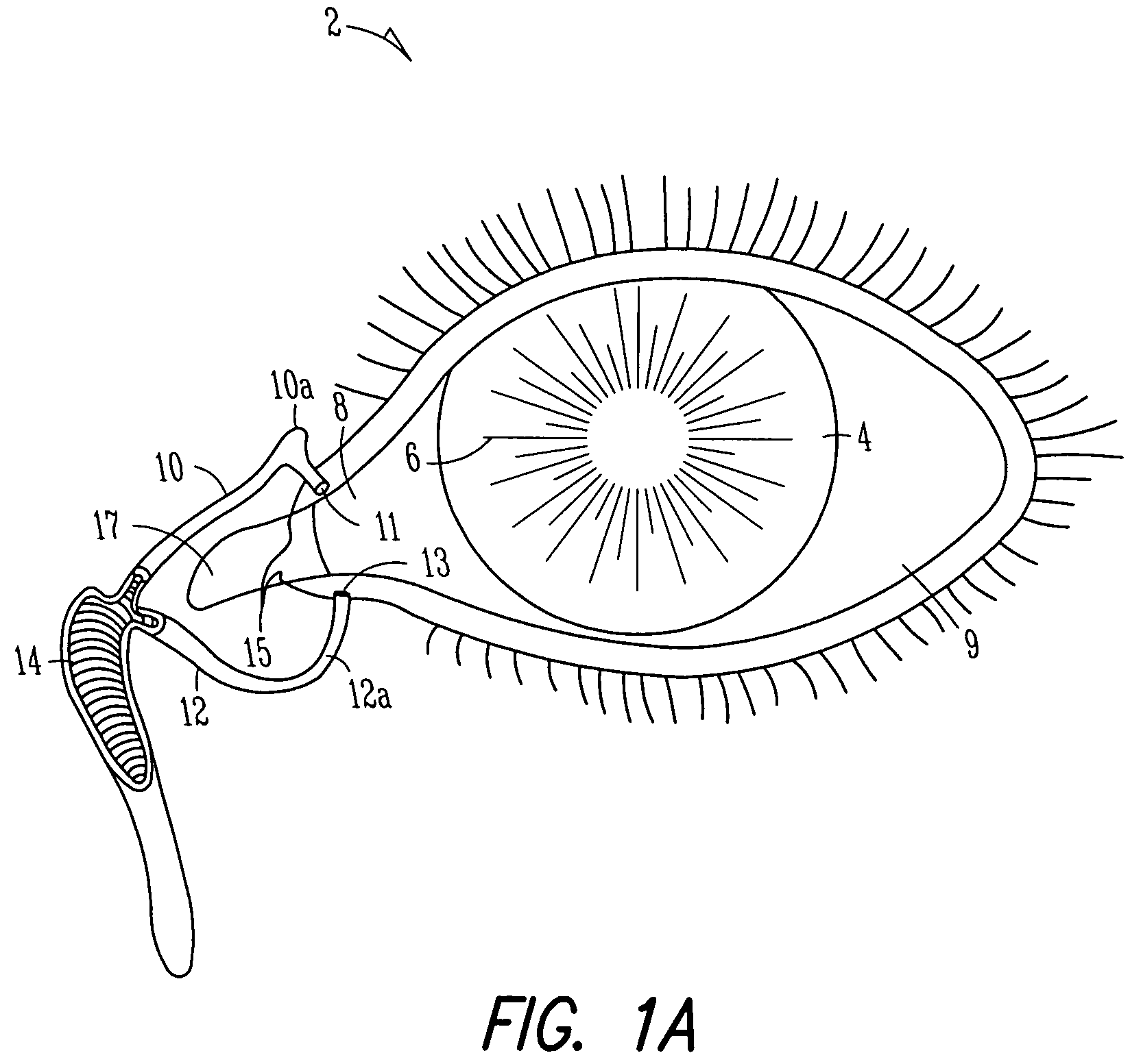 Insertion and extraction tools for lacrimal implants