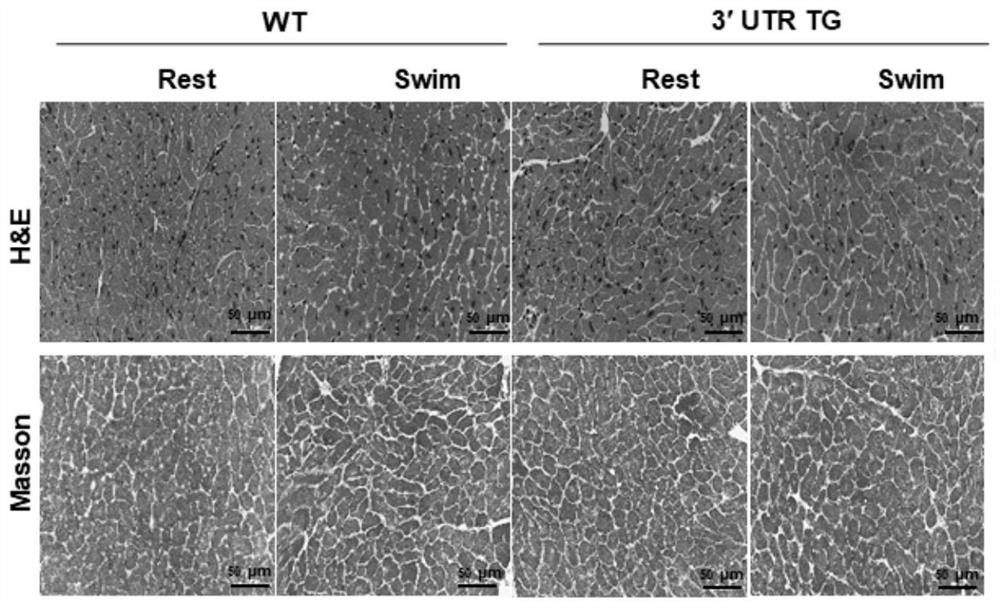 Application of Ckip-1 3' UTR in medicine for preventing and/or treating heart failure disease