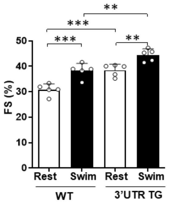 Application of Ckip-1 3' UTR in medicine for preventing and/or treating heart failure disease