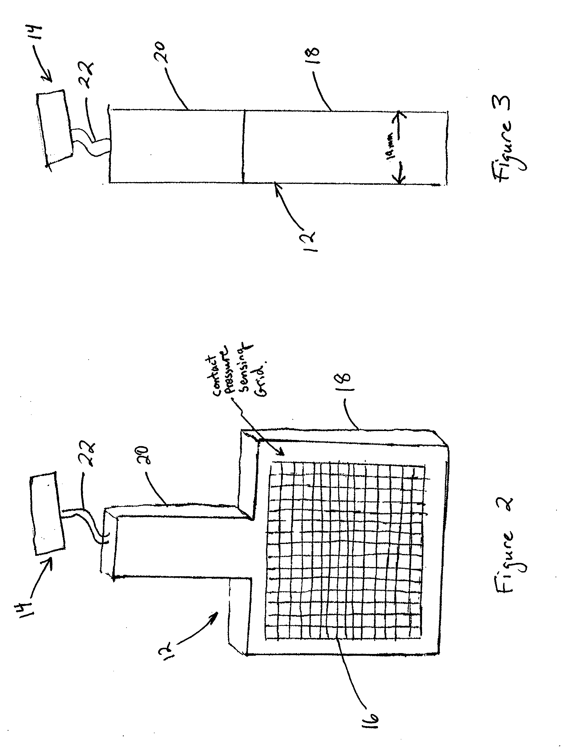 Spacer block with sensor for total knee arthroplasty