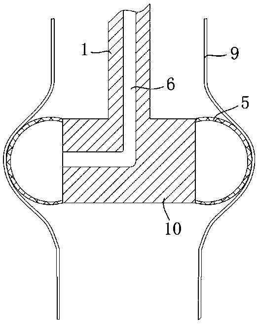 An esophagus-assisted peristaltic device