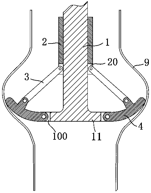 An esophagus-assisted peristaltic device